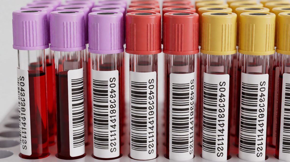Blood is made of cells and plasma